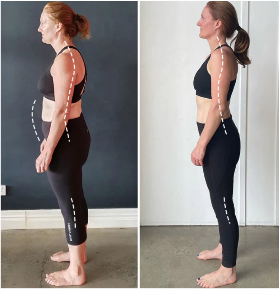 Retreat Posture Corrector